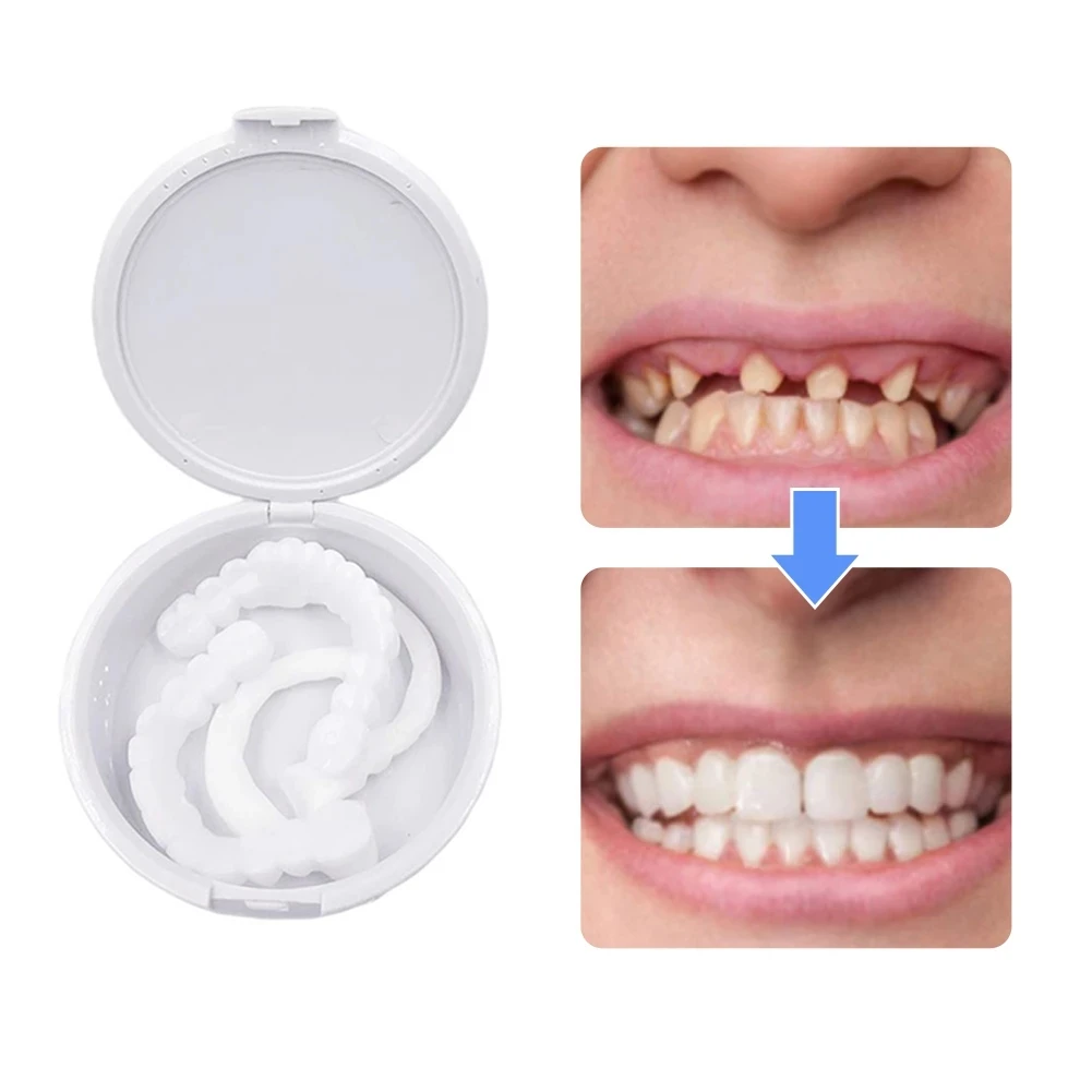 

1 Pair Teeth Veneers Whitening Dentures Imitation Braces Temporary False Teeth Cover Perfect Smile Comfortable Fit Denture Kit