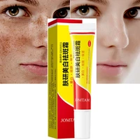 effective whitening freckle cream remove melasma acne spot pigment melanin dark spots pigmentation moisturizing whitening cream