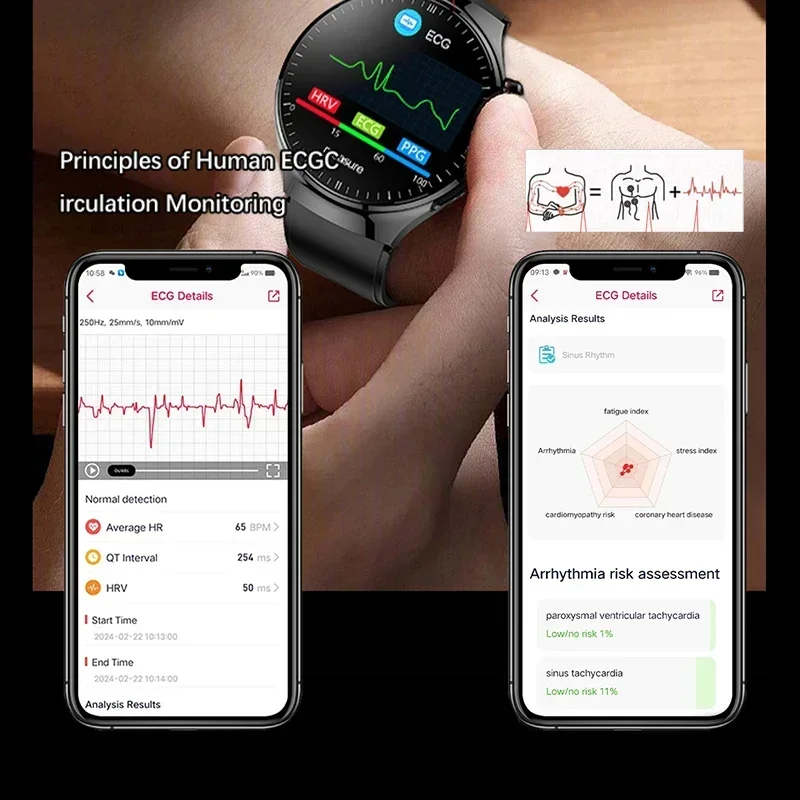 Смарт-часы с Bluetooth-вызовом новинка 2024 медицинский класс липиды в крови мочевая