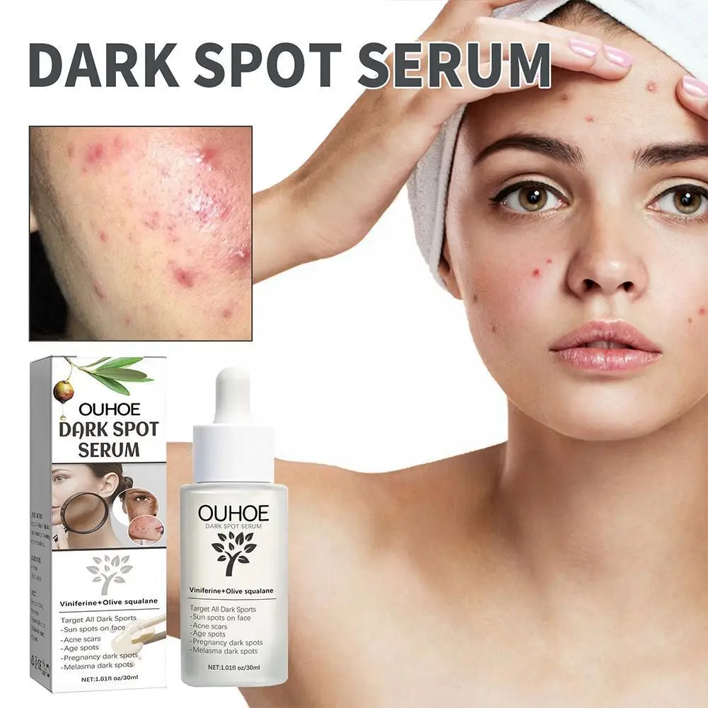 

Dark Spot Acne Essence Remove Dark Spot Melasma Cream Moisturizing Tone Essence Moisturizing Skin Improving Moisturizing S5i5