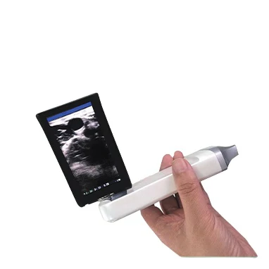 Amain MagiQ LW5X Linear BW Wireless 128 Element Medical Ultrasound Instrument With Rotate Built-in Screen