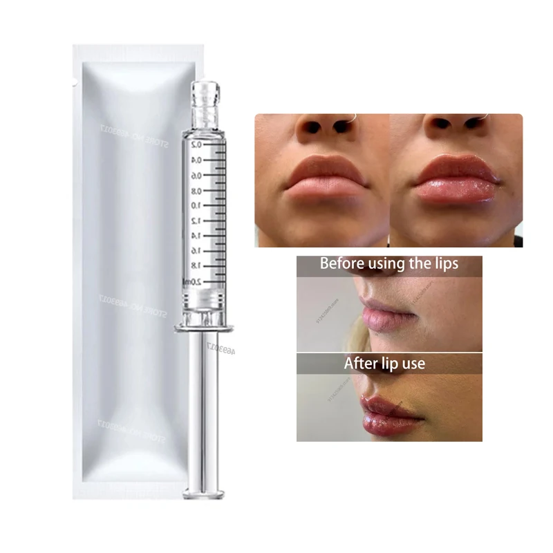 

2ml Hyaluronic Acid Lips Plumper Oil Crosslinked HA Face Nose Cheek Serum Anti Wrinkle Anti Aging Enhancement for Hyaluron Pen