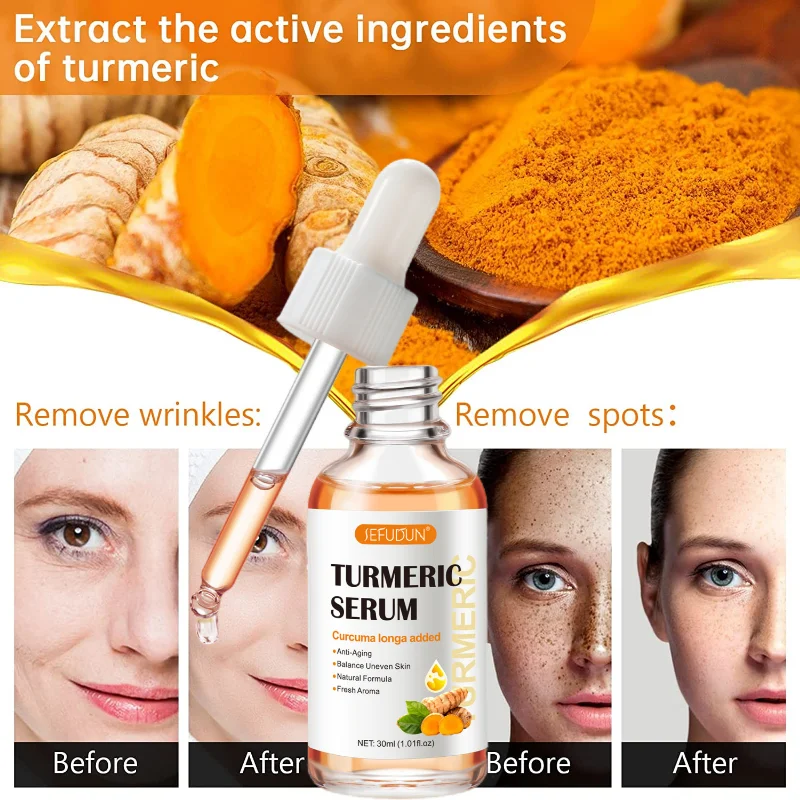 

Turmeric Serum for Dark Spots Corrector Serum for Face Body, Reduces Hyperpigmentation, Age Spots, Sun Spot, Improve Skin Tone