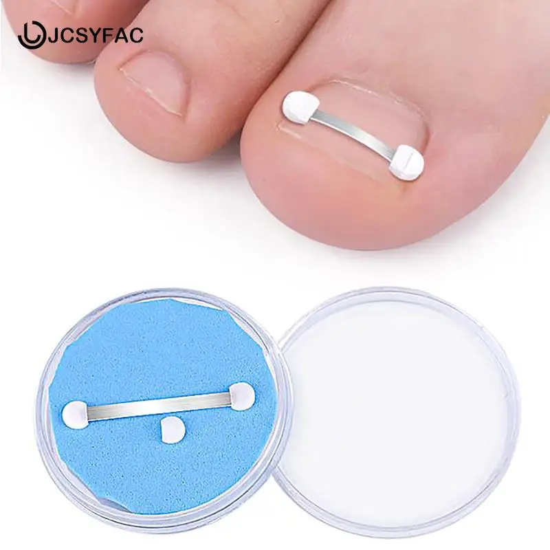 

Ingrown Toenail Corrector Tools Professional Ingrown Toenail Correction Foot Care Tool Pedicure Recover Embed Toe Nail Treatment