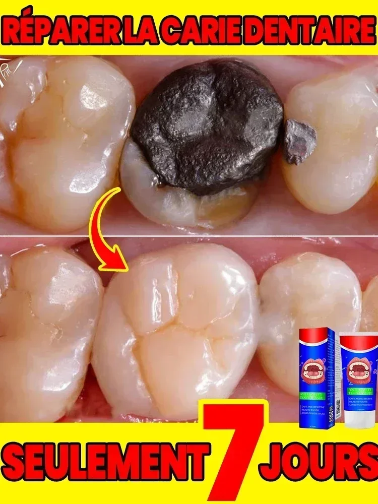 Новый стоматологический средство для удаления запаха во рту