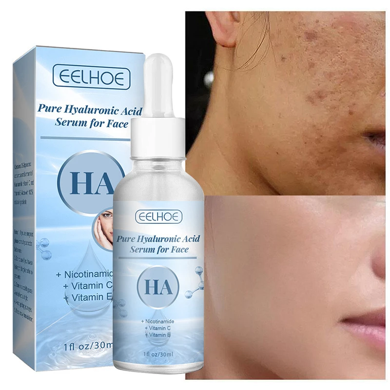 

Увлажняющая сыворотка для лица с гиалуроновой кислотой, Niacinamide, отбеливание, против морщин, осветление, удаление темных точек, красота, уход ...