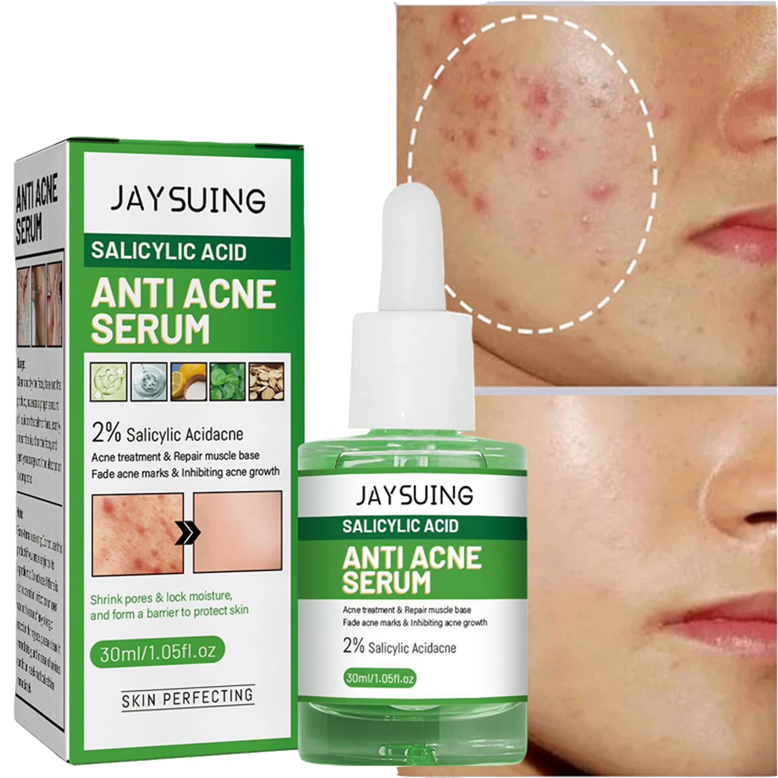 

Salicylic Acid Acne Treatment Face Serum Shrink Pores Oil Control Remove Pimple Blackhead Moisturizing Repair Skin Care Products