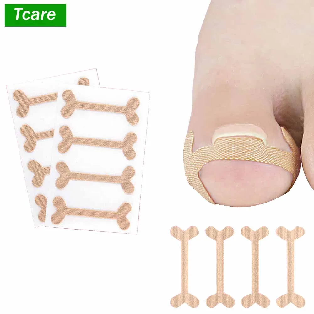 Tcare 1 Набор ногтей для желоб пластырь большого пальца быстрая деформация