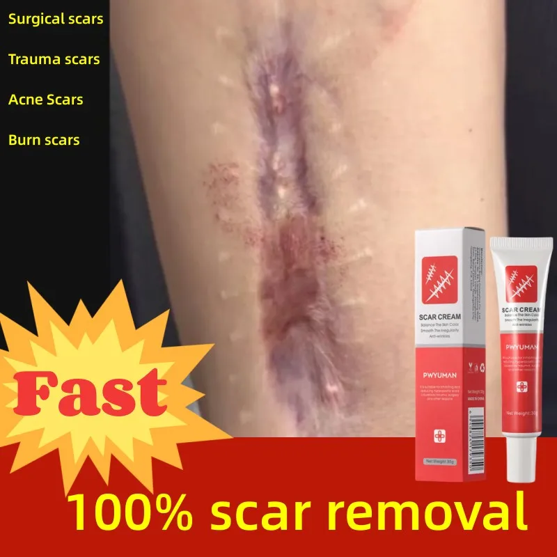 

Effective Scar Lightening Cream Removes Burns Scald Stretch Marks Trauma Acne Scars Repair Smoothing Skin Health Skin Care