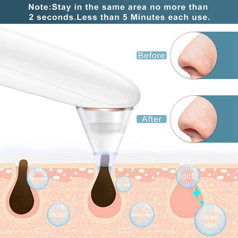 

Вакуумный прибор для удаления черных точек, устройство для удаления акне, с 5 щупами и зарядкой от USB, 3 всасывания