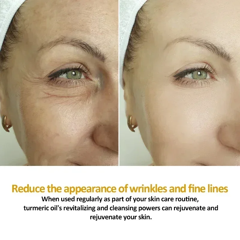 Рисунок 3 - Для удаления темных пятен куркума