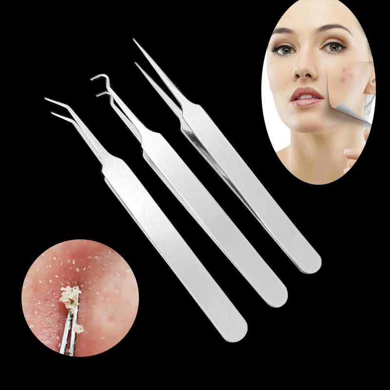 

1PCS Blackhead Removal Needle Black Dots Cleaner Stainless Steel Spot Extractor Skin Care Acne Treatment Blackhead Removal Tool