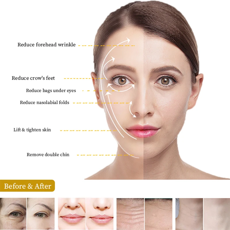 Дешевая цена прямые продажи с фабрики портативная мини-машина для подтяжки лица