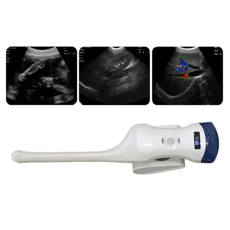 Фото CProbe-5CT Портативный беспроводной ультразвуковой сканер 2-в-1 для мобильных телефонов и iPad. №1