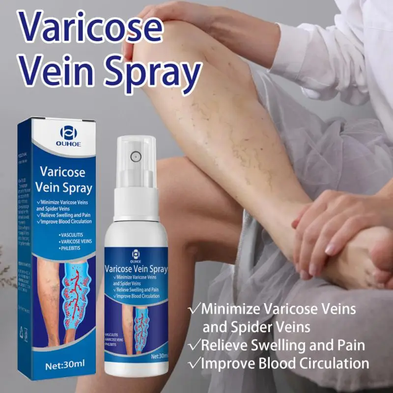 

30ml Varicose Veins Treatments Spray Relief Red Blood Vessel Swelling Pain Repair Earthworm Leg Raised Phlebitis Angiitis Mist