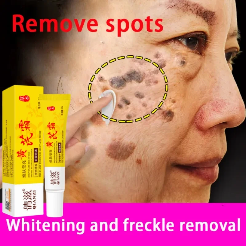 Осветляющий крем для лица Ниацинамид уменьшает концентрацию хлоазмы мелазмы