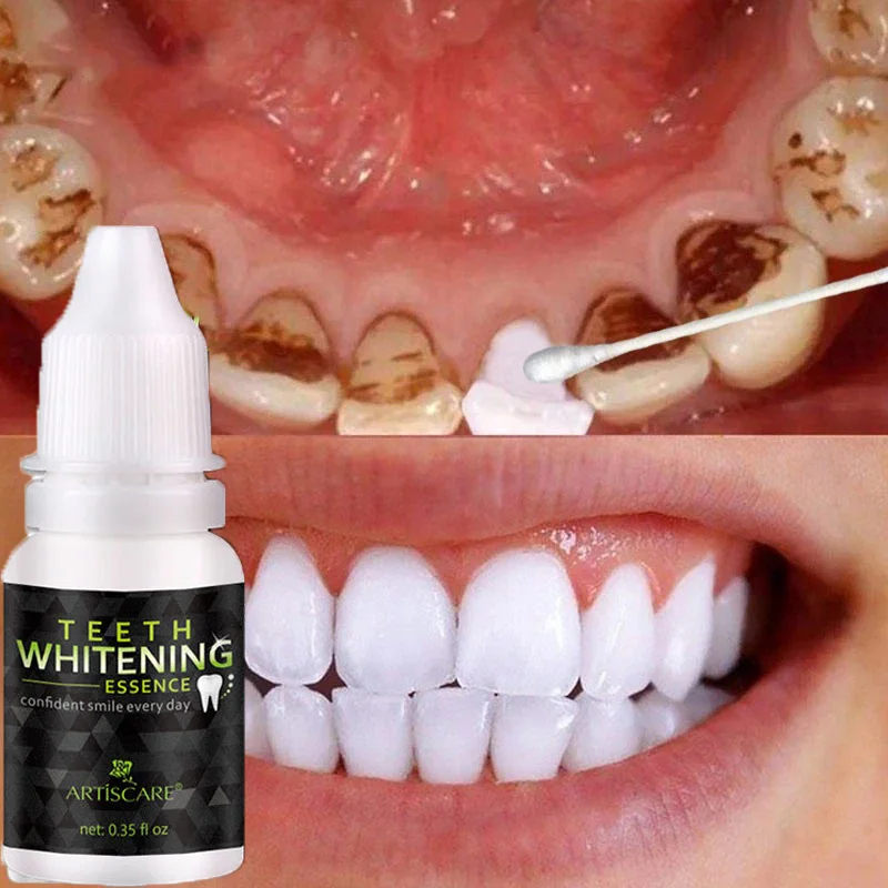 Tooth Whitening Serum Oral Hygiene Cleaning Remove Plaque Stains Bleaching Dental Tools Toothpaste Teeth Treatment Essence