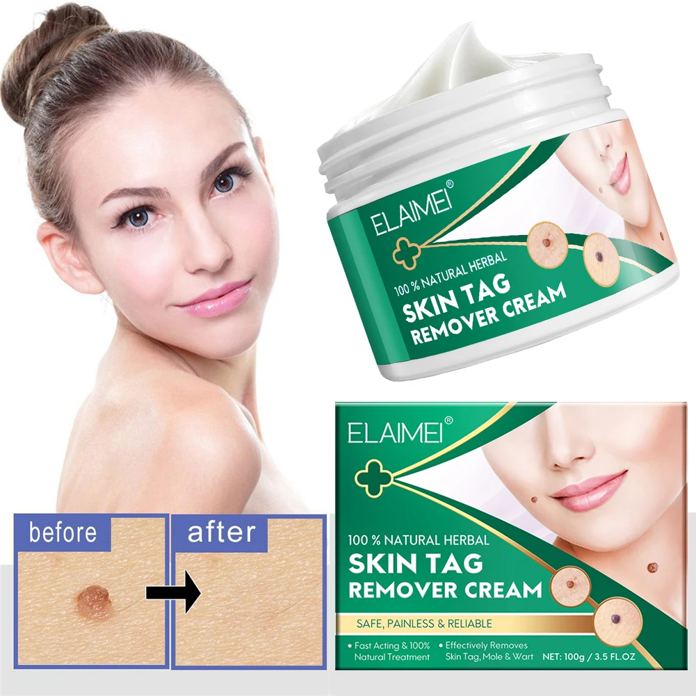 

Skin Tag Remover Cream Natural Skin Tag Treatment Ointment Painless Body Wart Mole Corn Removal Fast Acting Skin Care