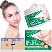 skin tag remover cream natural skin tag treatment ointment painless body wart mole corn removal fast acting skin care