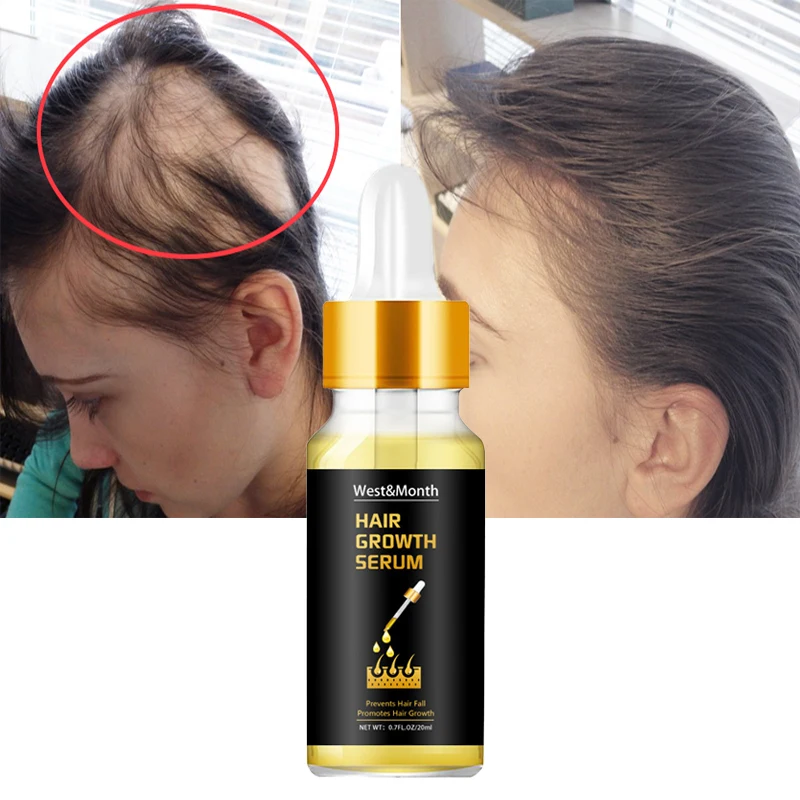 

Ginger Fast Hair Growth Essential Oil Anti Hair Loss Products Repair Scalp Serum Prevent Hair Thinning Dry Frizzy Anti Dandruff