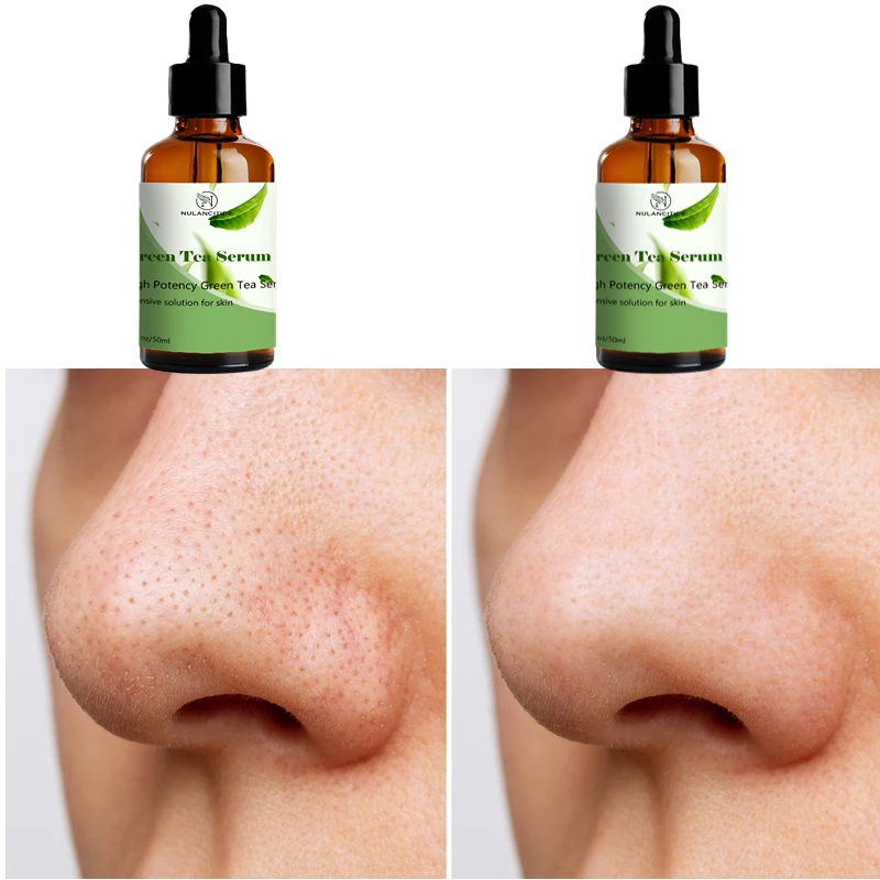 

Pure Natural Green Tea Essence Pores Shrink Remove Black Spots Improve Acne Blackheads Moisturizing And Firming Skin Care Beauty