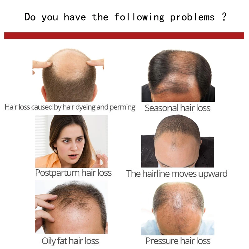 Сыворотка для восстановления волос выпадение биотин быстрого роста