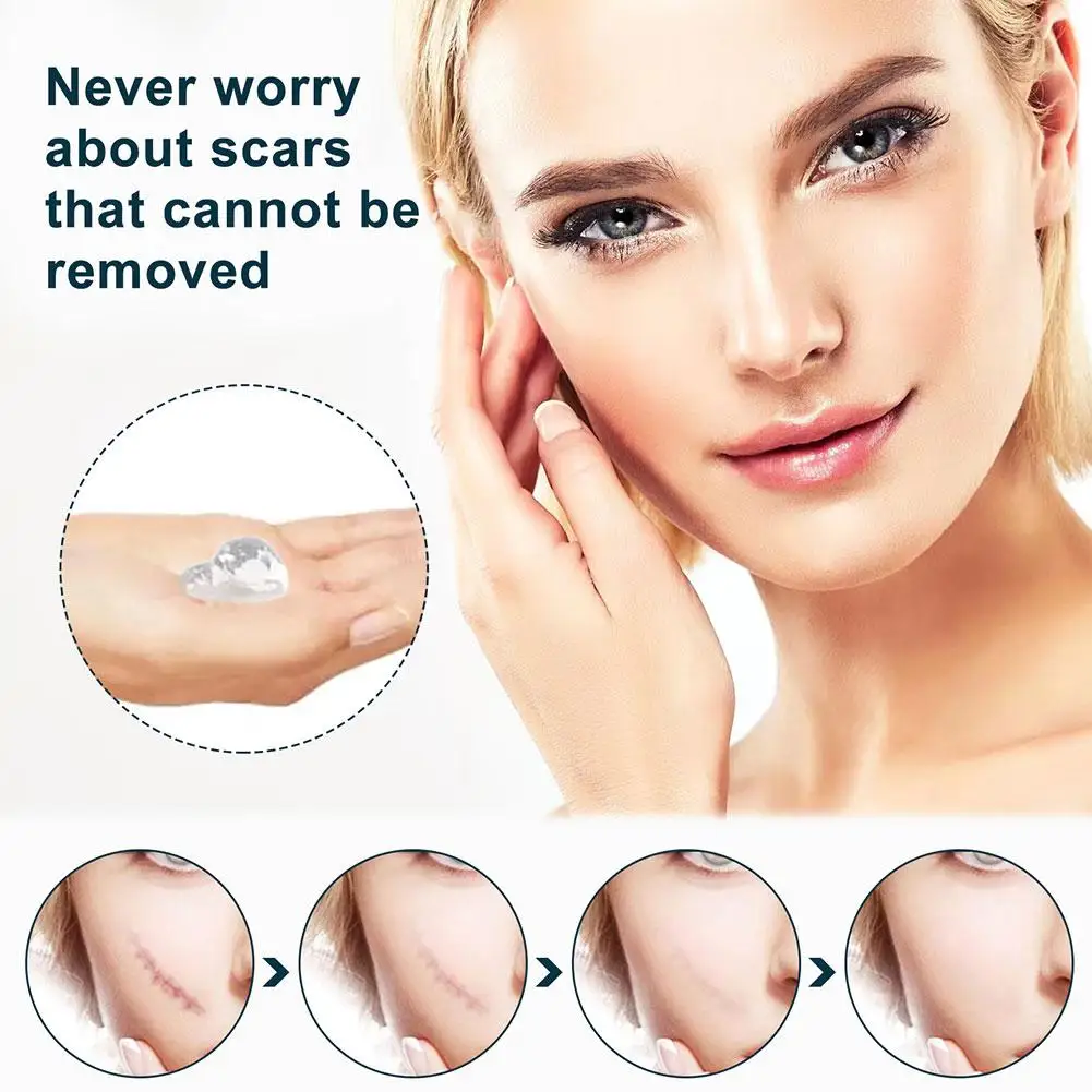 Рисунок 6 - Средство для удаления рубцов после акне