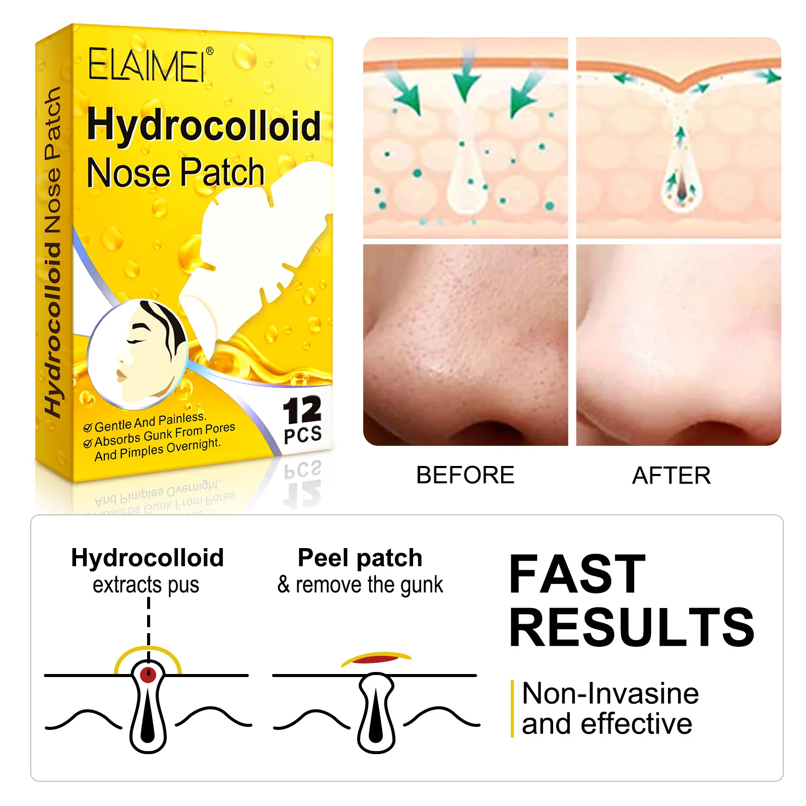 ELAIMEI New Product To Remove Blackhead Nose Sticker Hydrocolloid Clean Pores Acne Skin Repair Spot 12 Stickers