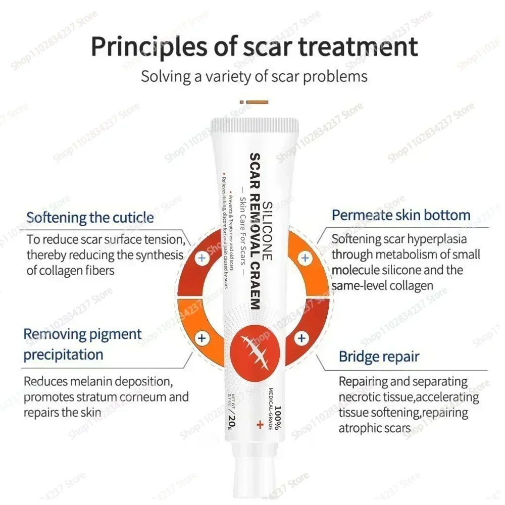 ГОРЯЧАЯ ПРОДАЖА восстанавливающий крем для удаления шрамов от прыщей растяжек
