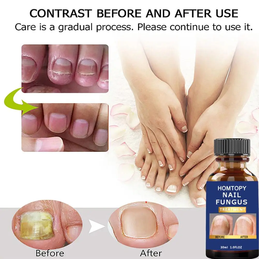 Рисунок 5 - Отвердитель для ногтей