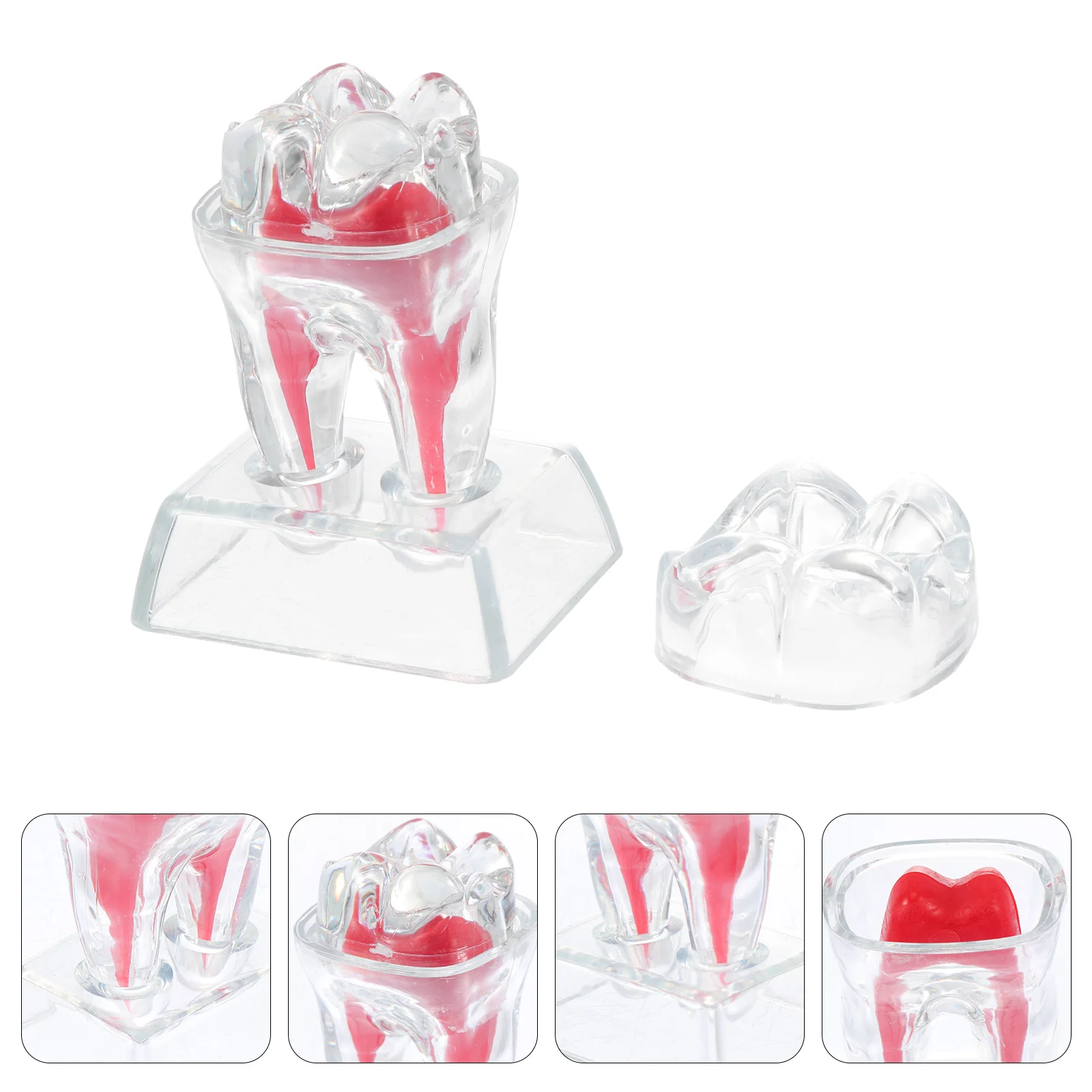 

1pc Implant Teeth Model Study Teach Model with Removable Teeth (Transparent color Red)