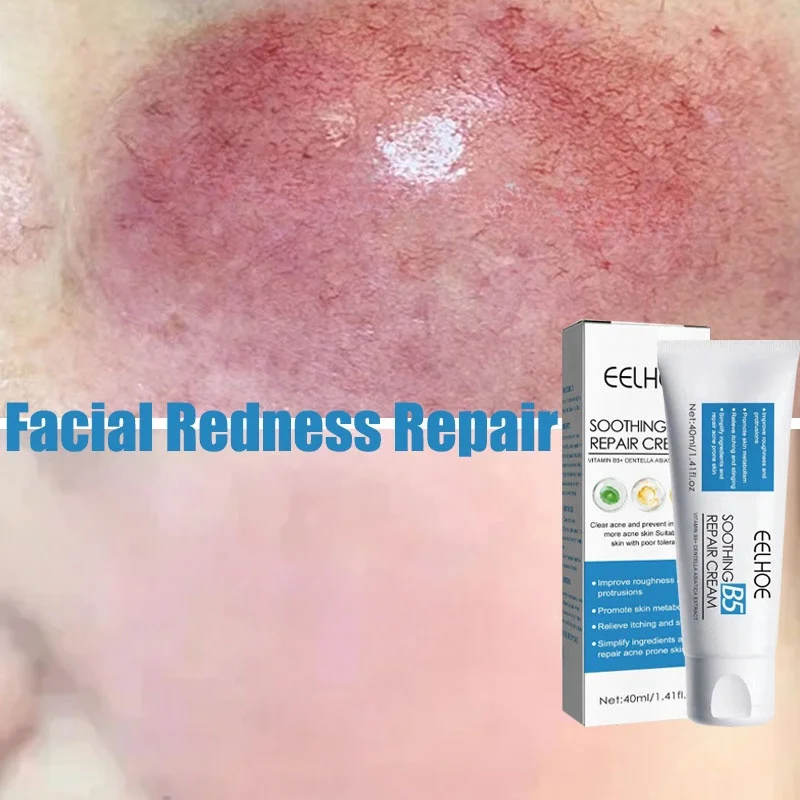 Увлажняющий крем для покраснения кожи лица улучшения чувствительной сухости