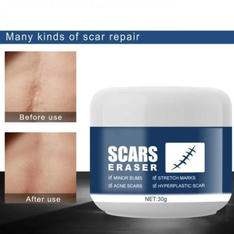 

Not Irritating Repair Damage Synthetic Scar Remove Cream