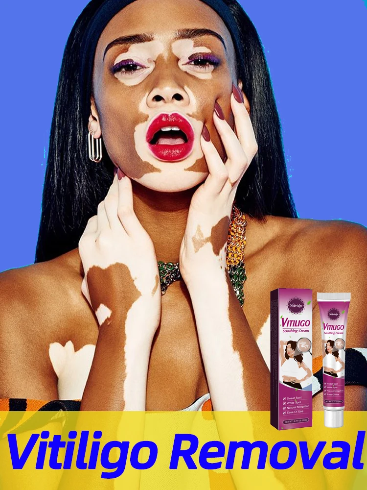 Крем для витилиго