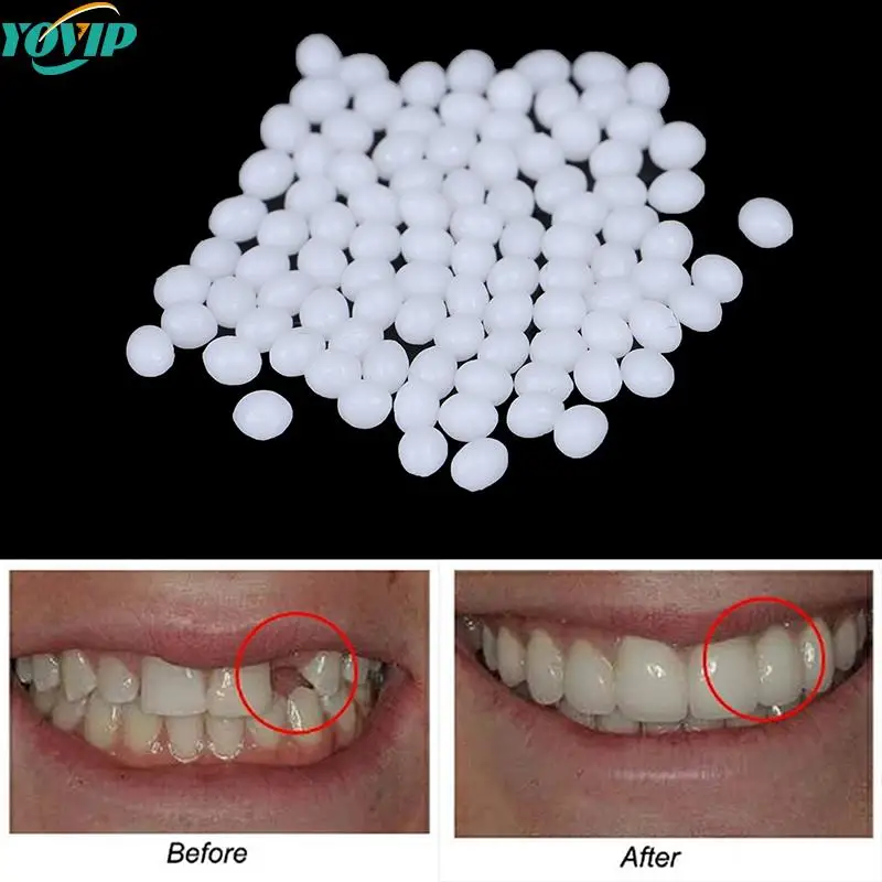 

5g-100 г набор для временного ремонта зубов, клей для зубных протезов, инструмент для отбеливания зубов, зубы и зазоры, твердый клей
