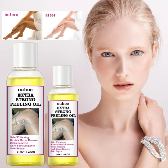 Yellow Peeling Oil Bleaching Dark Skin Spots Removing Blackheads Blemishes Treatment Lightening Knee Hands Body Whitening Oil 1