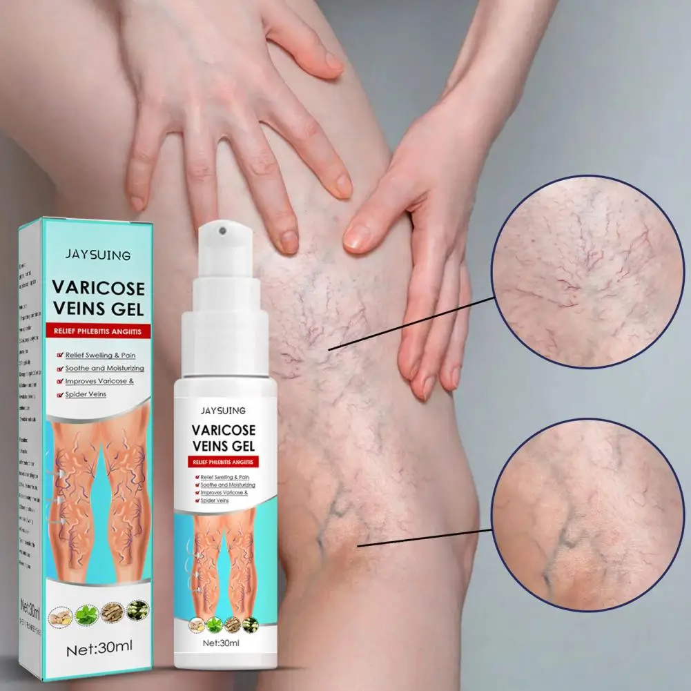 

30ml Skin Care Effective Relief Legs Veins Treatment Skin Care Gel for Body Varicose Essential Gel Varicose Gel