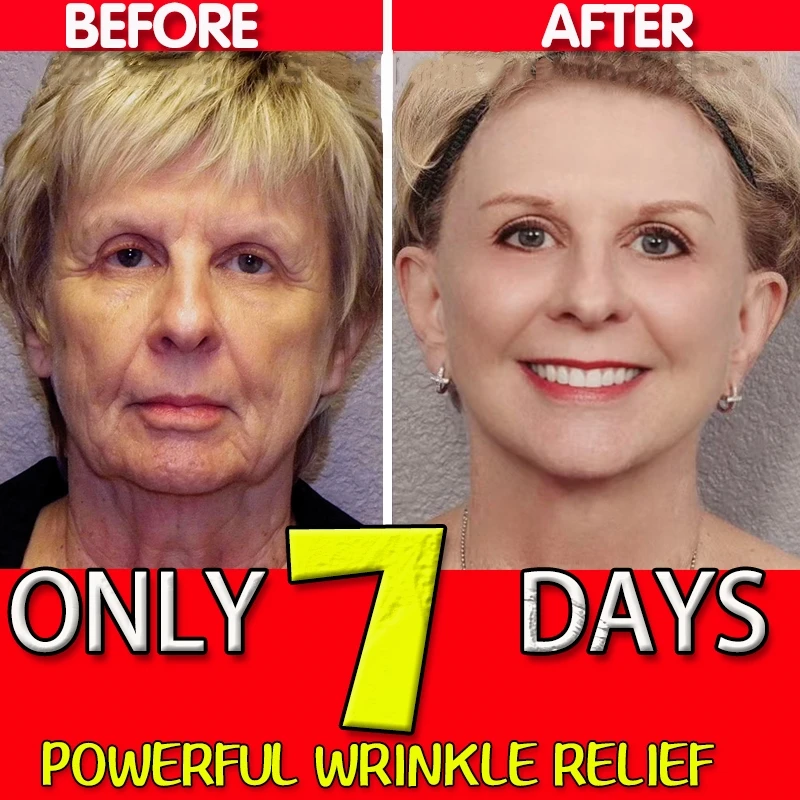 Retinol Instant Wrinkle Remover Face Serum Face Anti-Age Fade Fine Line Lift Firm Moisturize Essence Whiten Bighting Skin Care