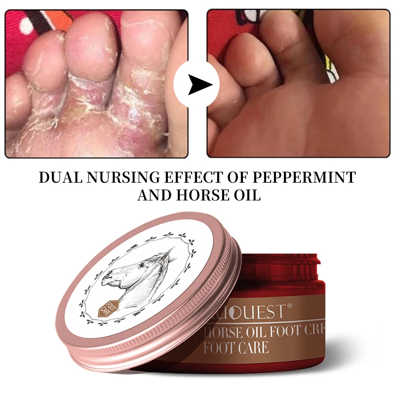 

Крем для ног на каблуках и трещинах, уход за кожей, удаление сухой омертвевшей кожи, лошадиное масло, смягчение, увлажнение, лечение ног для мужчин и женщин, 30 г