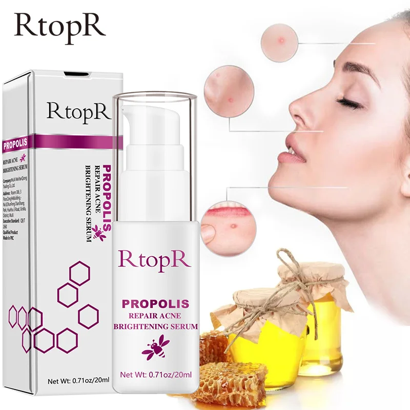 

RtopR Propolis Repair Acne Brightening Serum Acne Scar Treatment Spots Cleaning Shrink Pores Repairs Skin Whitening Control Oil