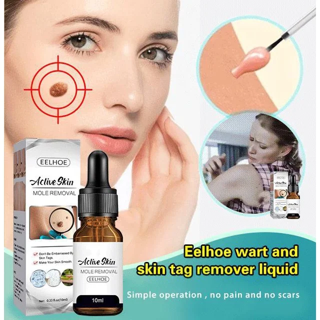

Buy One Get One Free Mole And Wart Essence Skin Flesh Removal And Repair