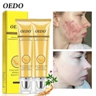 2 шт., мужской крем для лица, с экстрактом женьшеня, восстановление и отбеливание