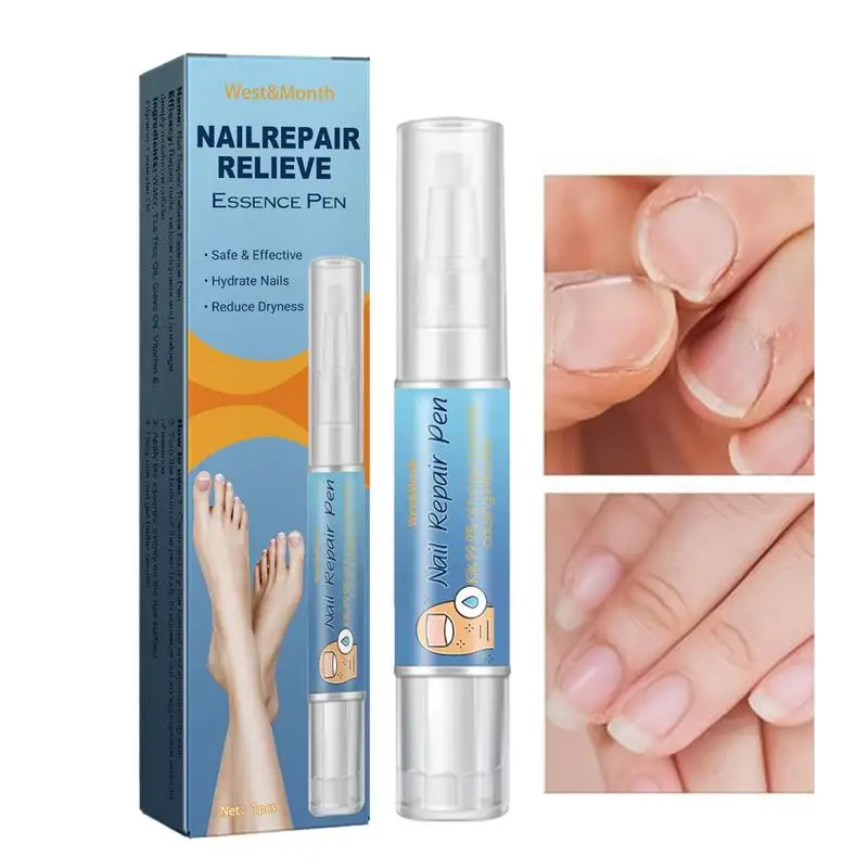 

Ручка для восстановления ногтей, ручка для обновления ногтей, эффективное портативное восстановление ногтей, ручка для ногтей для обесцвечивания и растрескивания