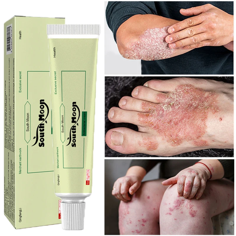 

Herbal Psoriasis Cream Antibacterial Dermatitis Eczema Treatment Anti-itch Relief Rash Urticaria Desquamation Ointment Skin Care