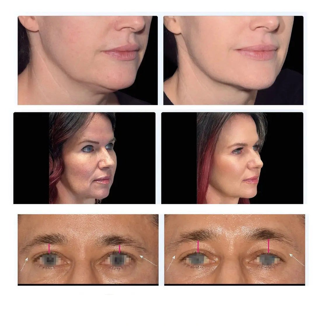 Рисунок 6 - Массажер для лица Ems