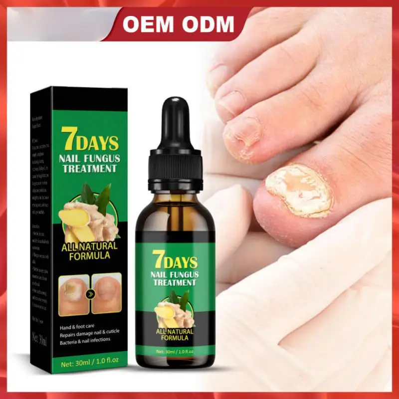 10/1 шт. лазерное устройство для лечения онихомикоза