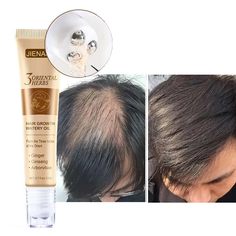 2023 Fast Hair Growth Oil Anti-Hair Loss Roller Massage Regrowth Serum Hair Thinning Treatment Repair Hair Roots for Women & Men