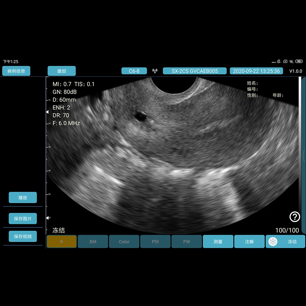 Беспроводной цветной доплеровский ультразвуковой датчик 2 в 1 беспроводной