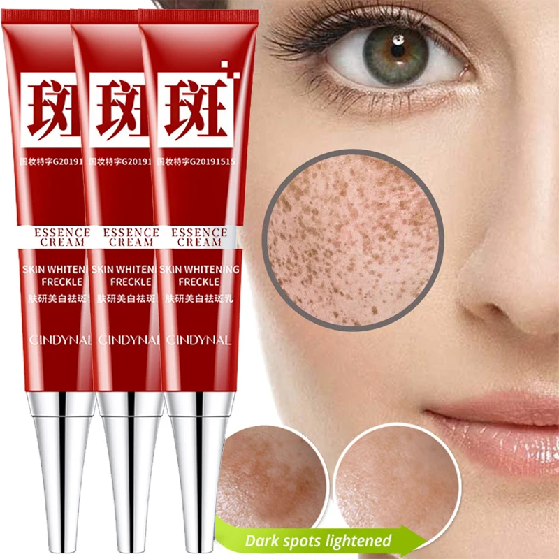 

Whitening Freckle Cream Fade Pigmentation Remove Dark Spots Melanin Melasma Brighten Moisturizing Face Skin Care Freckle Gel