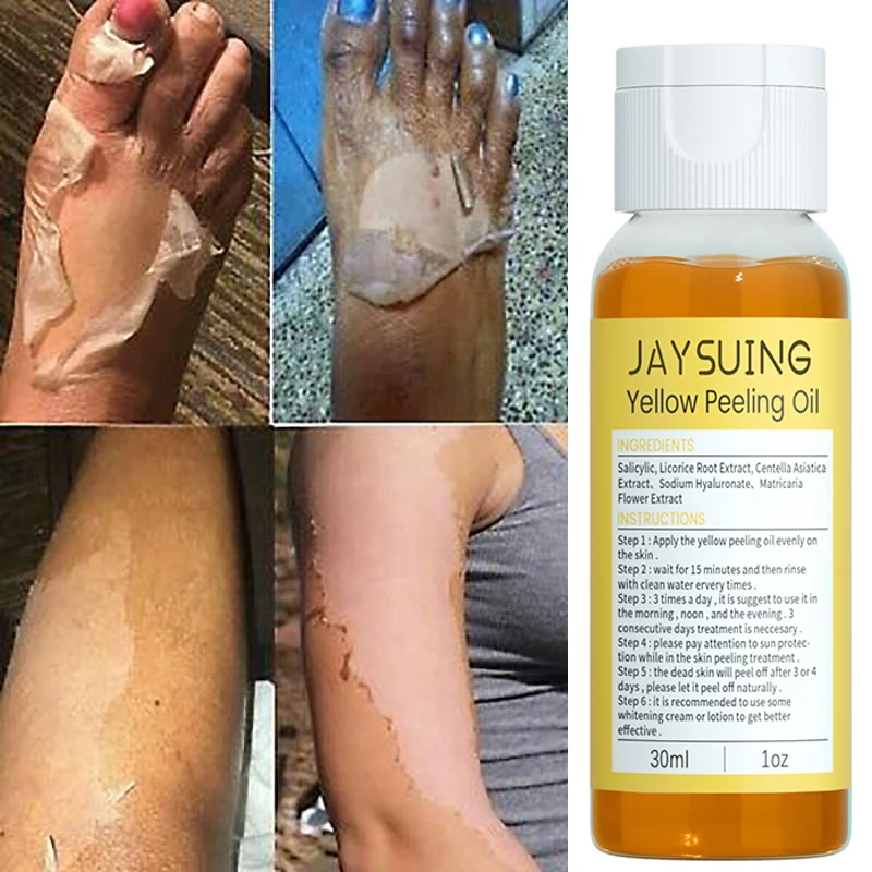 30ml Yellow Peeling Oil Body Exfoliation Knee Hands Melanin Bleaching Scrub Remove Dead Skin Brightening Whitening Beauty Care